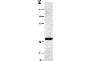 Western blot analysis of Human fetal liver tissue, using PRKAG1 Polyclonal Antibody at dilution of 1:500