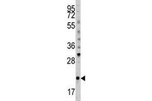 Western blot analysis of Bid antibody and mouse spleen tissue lysate (BID antibody  (AA 39-68))