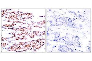Immunohistochemistry (IHC) image for anti-Jun B Proto-Oncogene (JUNB) (pSer79) antibody (ABIN1847496) (JunB antibody  (pSer79))