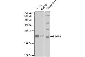 Western blot analysis of extracts of various cell lines, using PSMB9 antibody. (PSMB9 antibody)