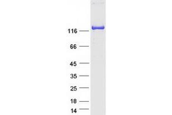 MYBPC2 Protein (Myc-DYKDDDDK Tag)