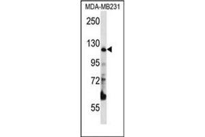 Western blot analysis of PITRM1 Antibody (Center) in MDA-MB231 cell line lysates (35ug/lane). (PITRM1 antibody  (Middle Region))