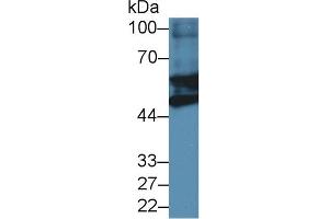 Detection of GFAP in Mouse Heart lysate using Polyclonal Antibody to Glial Fibrillary Acidic Protein (GFAP) (GFAP antibody  (AA 253-354))