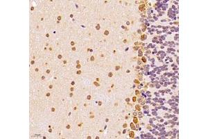 Immunohistochemistry of paraffin embedded mouse epencephalon using UQCC (ABIN7076094) at dilution of 1: 1000 (400x lens) (Ubiquinol-Cytochrome C Reductase Complex Chaperone (UQCC) antibody)