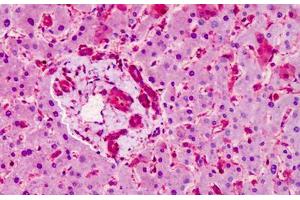 Human Liver: Formalin-Fixed, Paraffin-Embedded (FFPE) (SMO antibody  (AA 68-117))