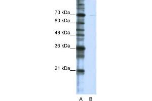 WB Suggested Anti-CSTF2T Antibody Titration:  0. (CSTF2T antibody  (C-Term))