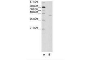 Image no. 1 for anti-PiggyBac Transposable Element Derived 1 (PGBD1) (AA 721-770) antibody (ABIN202922) (PGBD1 antibody  (AA 721-770))