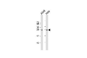 All lanes : Anti-IGF2 Antibody (Center R54) at 1:2000 dilution Lane 1: A549 whole cell lysate Lane 2: Hela whole cell lysate Lysates/proteins at 20 μg per lane.