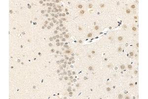 ABIN7094823 and ABIN7098874 at 1/100 staining Rat brain tissue by IHC-P. (MAML2 antibody  (C-Term))