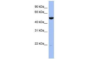 MAP2K7 antibody used at 1 ug/ml to detect target protein.