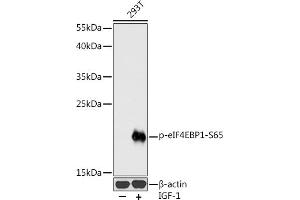 Western blot analysis of extracts of 293T cells, using Phospho-eIF4EBP1-S65 antibody (ABIN3023531, ABIN3023532, ABIN3023533 and ABIN6225390) at 1:1000 dilution. (eIF4EBP1 antibody  (pSer65))