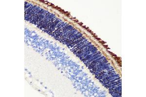Immunohistochemistry of paraffin-embedded mouse retina using PDE6B antibody (ABIN6132473, ABIN6145363, ABIN6145364 and ABIN6222688) at dilution of 1:200 (40x lens). (PDE6B antibody  (AA 1-190))