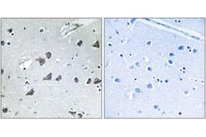 Immunohistochemistry analysis of paraffin-embedded human brain tissue, using EIF3F Antibody. (EIF3F antibody  (AA 81-130))