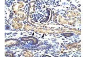 Image no. 1 for anti-SNAIL (SNAI1) (N-Term) antibody (ABIN6735858) (SNAIL antibody  (N-Term))