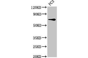 Western Blot Positive WB detected in: PC-3 whole cell lysate All lanes: SCNN1B antibody at 8 μg/mL Secondary Goat polyclonal to rabbit IgG at 1/50000 dilution Predicted band size: 73, 78 kDa Observed band size: 73 kDa (SCNN1B antibody  (AA 554-640))