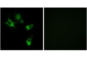 Immunofluorescence analysis of COS7 cells, using MAST4 Antibody. (MAST4 antibody  (AA 251-300))