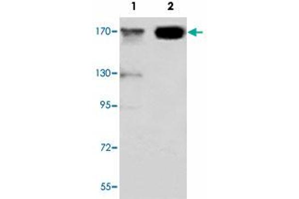 KDM5C anticorps  (C-Term)