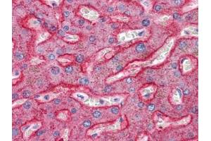 Human Liver: Formalin-Fixed, Paraffin-Embedded (FFPE) (SQSTM1 antibody  (C-Term))