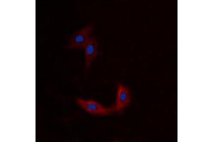 Immunofluorescent analysis of BMX staining in A549 cells. (BMX antibody  (N-Term))