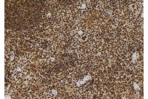ABIN6272986 at 1/100 staining Mouse spleen tissue by IHC-P. (ADRM1 antibody  (Internal Region))