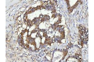 IHC analysis of CBR1 using anti-CBR1 antibody (ABIN7600015). (CBR1 antibody  (AA 14-262))