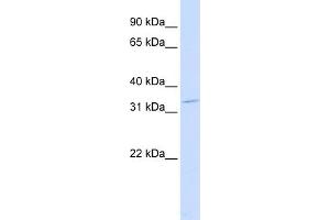 WB Suggested Anti-OTX2 Antibody Titration:  0.