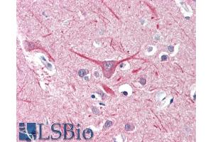 ABIN570789 (5µg/ml) staining of paraffin embedded Human Cortex. (UBR2 antibody  (Internal Region))