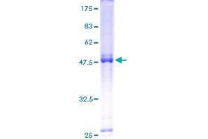 DEP Domain Containing 1B (DEPDC1B) (AA 1-187) protein (GST tag)