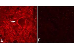 Tenascin R antibody