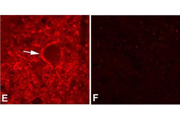 Tenascin R antibody