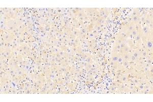 Detection of a2M in Human Liver Tissue using Polyclonal Antibody to Alpha-2-Macroglobulin (a2M) (alpha 2 Macroglobulin antibody  (AA 616-856))