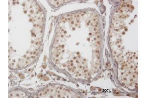 Immunoperoxidase of monoclonal antibody to PIM1 on formalin-fixed paraffin-embedded human testis.