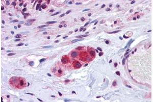 Human Small Intestine, Submucosal Plexus: Formalin-Fixed, Paraffin-Embedded (FFPE) (ZEB2 antibody  (C-Term))