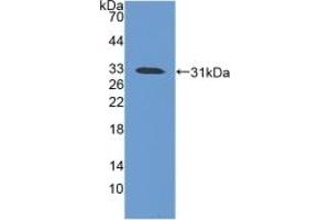 Detection of Recombinant iNV, Mouse using Polyclonal Antibody to Involucrin (INV) (Involucrin antibody  (AA 301-460))
