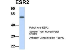 Host:  Rabbit  Target Name:  ESR2  Sample Type:  Human Fetal Muscle  Antibody Dilution:  1. (ESR2 antibody  (N-Term))