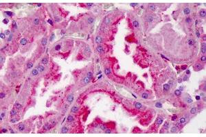 Human Kidney: Formalin-Fixed, Paraffin-Embedded (FFPE) (APOA1 antibody  (AA 188-199))