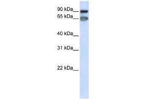 WB Suggested Anti-MED16 Antibody Titration: 0. (MED16 antibody  (C-Term))