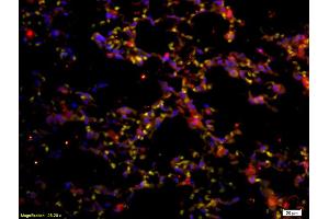 Formalin-fixed and paraffin embedded mouse lung labeled with Anti-CD45 Polyclonal Antibody, Unconjugated (ABIN669606) at 1:200 followed by conjugation to the secondary antibody Goat Anti-Rabbit IgG, PE conjugated used at 1:200 dilution for 40 minutes at 37°C (CD45 antibody  (AA 1210-1304))