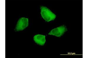 Immunofluorescence of purified MaxPab antibody to PDCD6IP on HeLa cell. (ALIX antibody  (AA 1-868))
