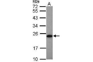 WB Image Sample (50 ug of whole cell lysate) A: Mouse brown adipose tissue 12% SDS PAGE antibody diluted at 1:1000 (Adenylate Kinase 1 antibody)