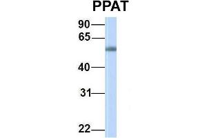 Host:  Rabbit  Target Name:  PPAT  Sample Type:  Human Fetal Muscle  Antibody Dilution:  1. (PPAT antibody  (C-Term))