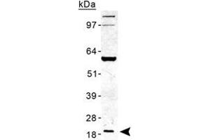 Western blot analysis of TMED10 in human liver lysate with TMED10 polyclonal antibody . (TMED10 antibody  (AA 100-200))