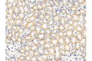 anti-Patched 2 (PTCH2) (Internal Region) antibody
