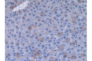 Immunohistochemistry (IHC) image for anti-Fibronectin (AA 355-558) antibody (ABIN7429001)