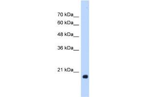 WB Suggested Anti-HSPB6 Antibody Titration:  1. (HSPB6 antibody  (Middle Region))