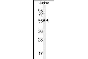 PODNL1 Antibody (Center) (ABIN656141 and ABIN2845479) western blot analysis in Jurkat cell line lysates (35 μg/lane). (PODNL1 antibody  (AA 167-195))