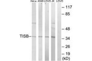Western blot analysis of extracts from Jurkat/HeLa/A549/LOVO cells, using TISB (Ab-92) Antibody. (ZFP36L1 antibody  (AA 58-107))