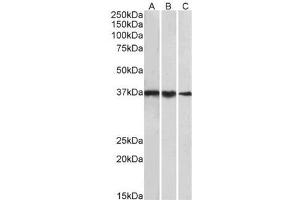 P31930PU-N TBP antibody staining of cell line NIH3T3 (A), Mouse Testis (B) and Rat Testis (C) lysates at 1 µg/ml (35µg protein in RIPA buffer). (TBP antibody  (Internal Region))
