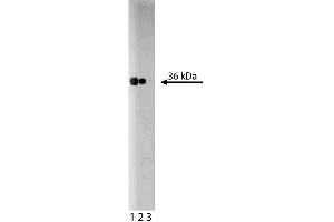Western blot analysis of RACK1 on a Jurkat lysate. (GNB2L1 antibody  (AA 113-317))
