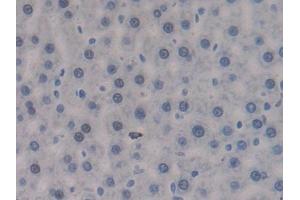IHC-P analysis of Rat Liver Tissue, with DAB staining. (PTPRJ antibody  (AA 1033-1277))